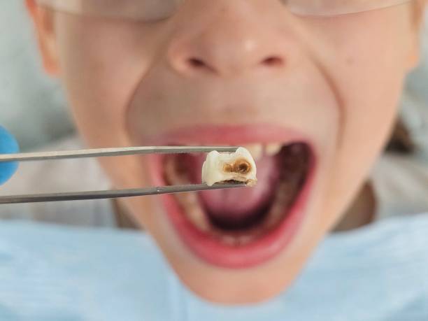 Best Walk-In Emergency Dentist in Wilson, AR